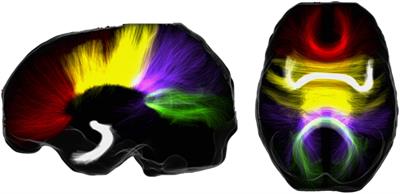 Interhemispheric Brain Communication and the Evolution of Turn-Taking in Mammals